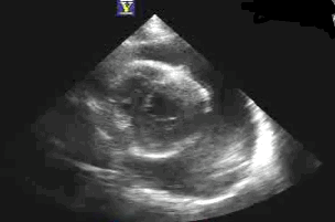 EEU case image missing